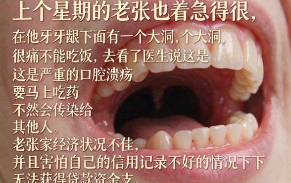 牙龈下面口腔溃疡很长的口子，罗列五个无视黑白户网贷app